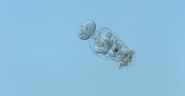 Foto einer Alge unter dem Mikroskop.