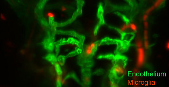 Zerebrale Blutgefäße des Zebrafischembryos am zweiten Tag der Normalentwicklung Foto: Brent Derry Zerebrale Blutgefäße des Zebrafischembryos am zweiten Tag der Normalentwicklung Foto: Brent Derry