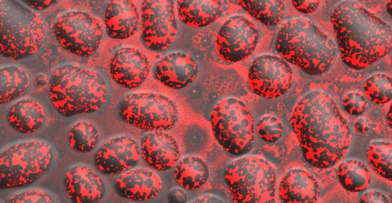 Mikroskopisch kleine Wassertropfen, die mit einer Schicht Lecithine überzogen sind. (Foto: Max-Planck-Institut für Kolloid- und Grenzflächenforschung/Roland Knorr)